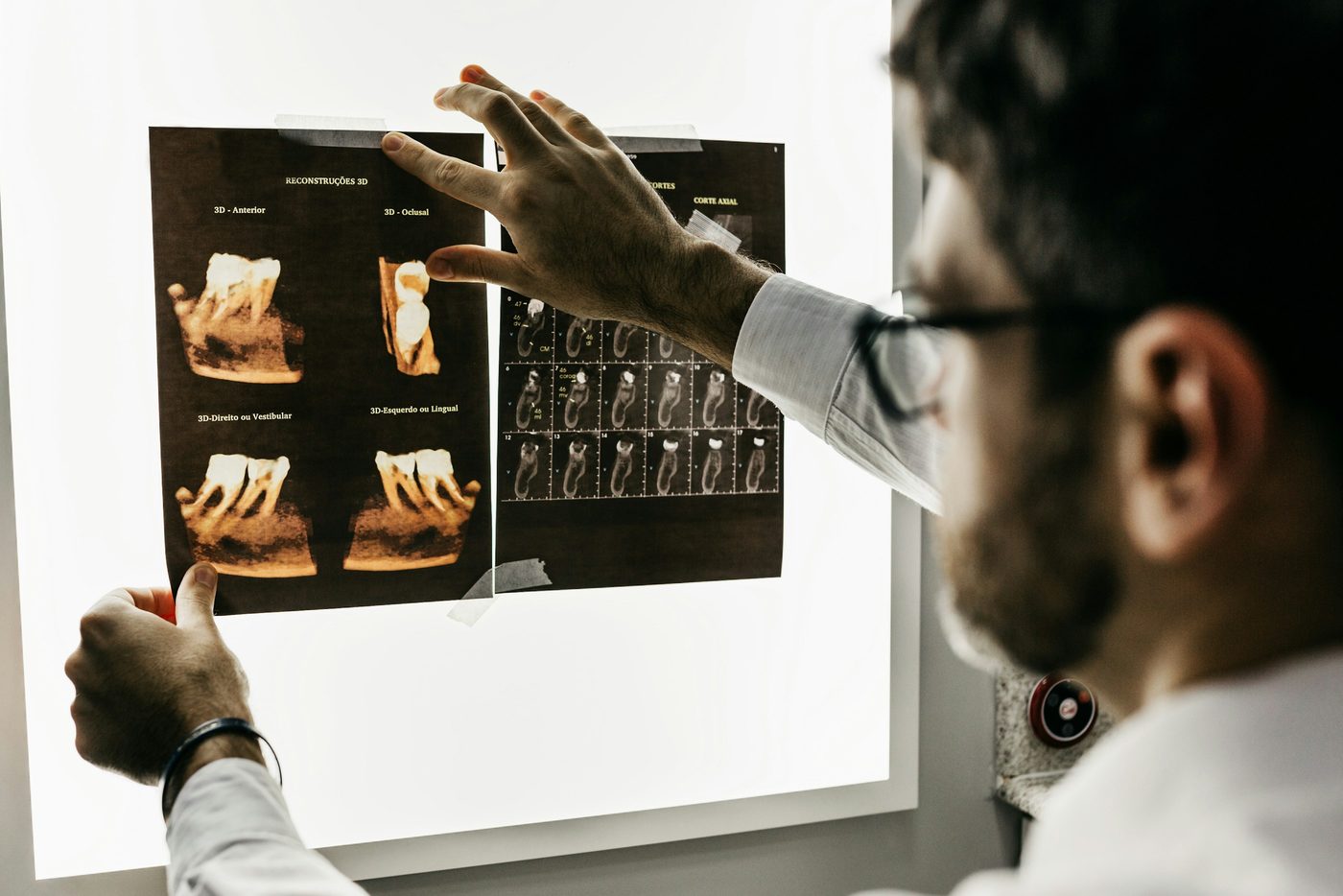 Dentist reviewing digital dental X-ray images